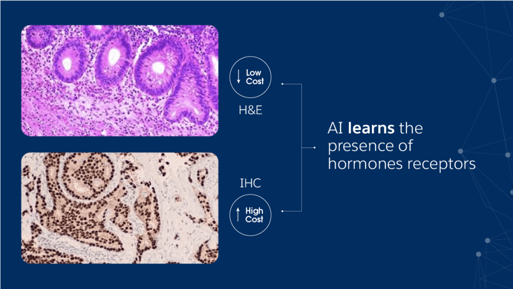 AI learns the presence of hormone receptors